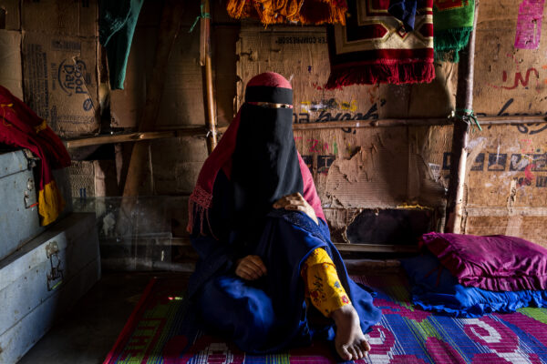 A Rohingya refugee with disability in her left foot, at her home in Hyderabad, India. 
